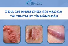 3 Địa chỉ khám chữa sùi mào gà tại TPHCM - 3 Địa Chỉ Khám Chữa Sùi Mào Gà Tại TPHCM Uy Tín Hàng Đầu 3 Địa chỉ khám chữa sùi mào gà tại TPHCM