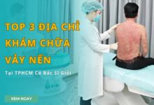 Top 3 địa chỉ khám chữa vảy nến tại TPHCM - Top 3 Địa Chỉ Khám Chữa Vảy Nến Tại TPHCM Có Bác Sĩ Giỏi Top 3 địa chỉ khám chữa vảy nến tại TPHCM