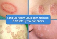 5 Địa chỉ khám chữa bệnh nấm da ở TPHCM - 5 Địa Chỉ Khám Chữa Bệnh Nấm Da ở TPHCM Uy Tín, Bác Sĩ Giỏi 5 Địa chỉ khám chữa bệnh nấm da ở TPHCM